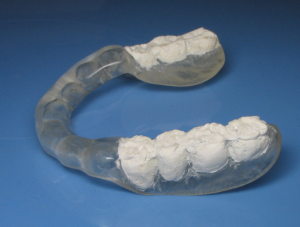 Radiographic guide with missing teeth coated in barium