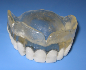 Radiographic guide with a full arch of teeth