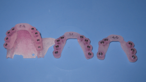 Materialize® surgical guides